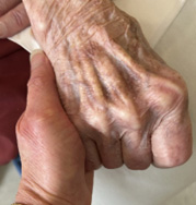 two hands
